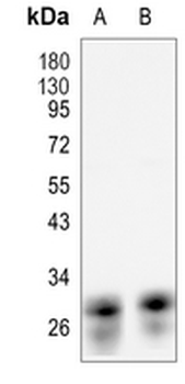 CD230 Rabbit Monoclonal Antibody