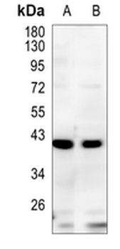 TMOD2 Rabbit Monoclonal Antibody