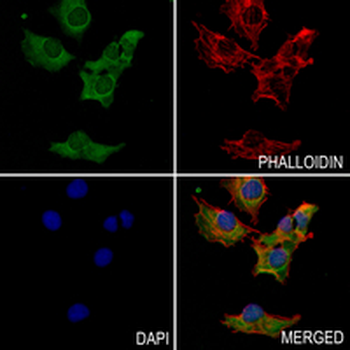 TMOD2 Rabbit Monoclonal Antibody