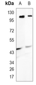 GLUR2/3 Rabbit Monoclonal Antibody