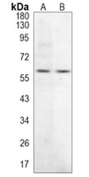 Tyrosine Hydroxylase Rabbit Monoclonal Antibody