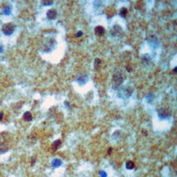Tyrosine Hydroxylase Rabbit Monoclonal Antibody