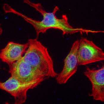 PSD95 Rabbit Monoclonal Antibody