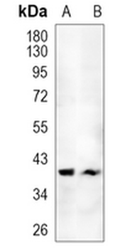 OTX1 Rabbit Monoclonal Antibody