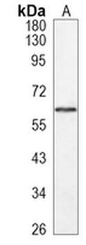 TYRP1 Rabbit Monoclonal Antibody