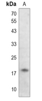 Alpha/Beta-synuclein Rabbit Monoclonal Antibody
