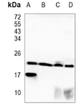 CRCP Rabbit Monoclonal Antibody