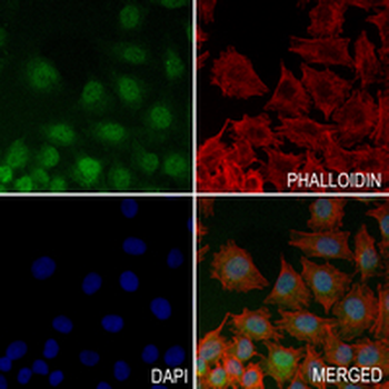 CRCP Rabbit Monoclonal Antibody