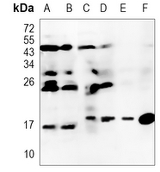 Prefoldin 5 Rabbit Monoclonal Antibody