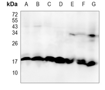 nm23-H2 Rabbit Monoclonal Antibody