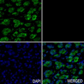 nm23-H2 Rabbit Monoclonal Antibody