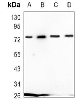ACAS2 Rabbit Monoclonal Antibody
