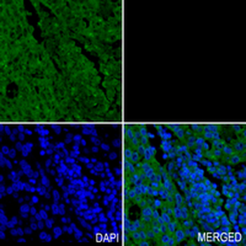 ACAS2 Rabbit Monoclonal Antibody