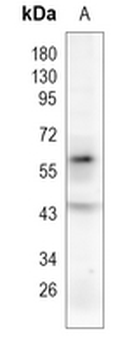 TRAF6 Rabbit Monoclonal Antibody