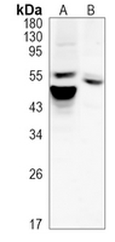 AKT Rabbit Monoclonal Antibody