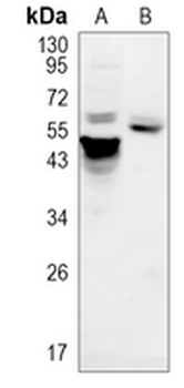 AKT1 Rabbit Monoclonal Antibody