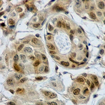 AKT1 Rabbit Monoclonal Antibody