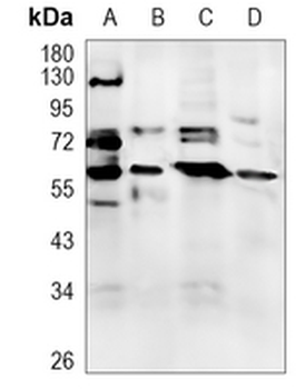 PPP3CA Rabbit Monoclonal Antibody