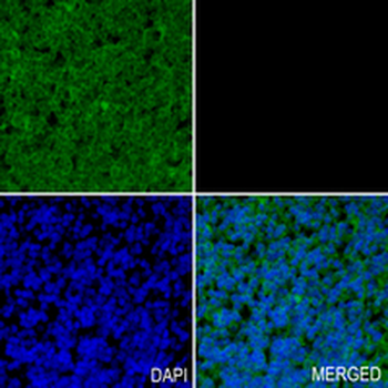PPP3CA Rabbit Monoclonal Antibody