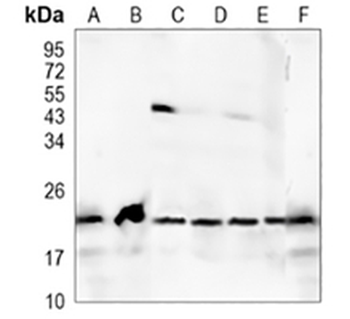 RAB22 Rabbit Monoclonal Antibody