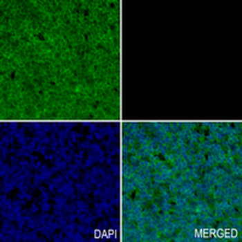 RAB22 Rabbit Monoclonal Antibody