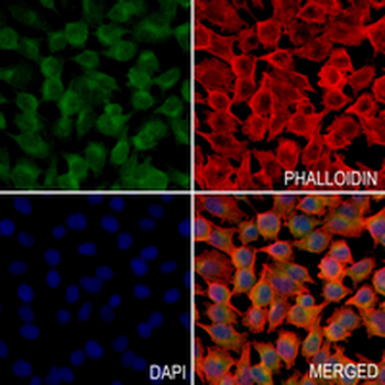RAB22 Rabbit Monoclonal Antibody