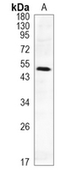 AKT (Phospho-S124) Rabbit Monoclonal Antibody