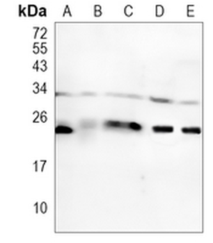 RAB8A Rabbit Monoclonal Antibody