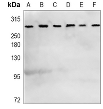 mTOR (Phospho-S2481) Rabbit Monoclonal Antibody
