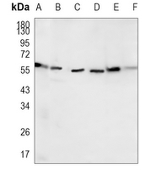 Cytokeratin 10 Rabbit Monoclonal Antibody