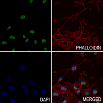 KDM4B Rabbit Monoclonal Antibody