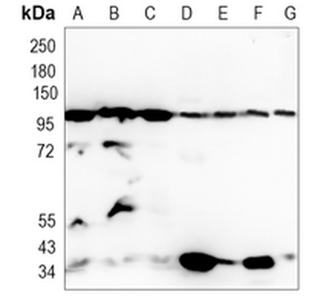 SFPQ Rabbit Monoclonal Antibody