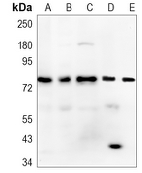 THOC1 Rabbit Monoclonal Antibody