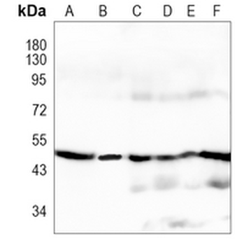 ATP5B Rabbit Monoclonal Antibody