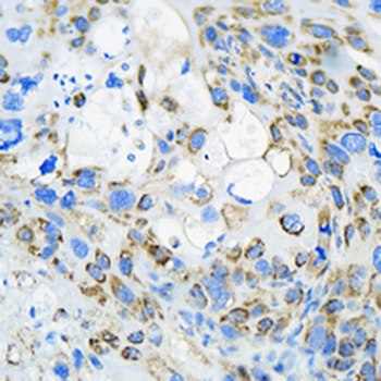 ATP5B Rabbit Monoclonal Antibody