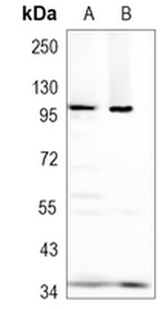 VPS18 Rabbit Monoclonal Antibody