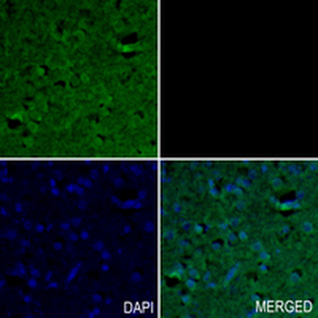 LCAT Rabbit Monoclonal Antibody