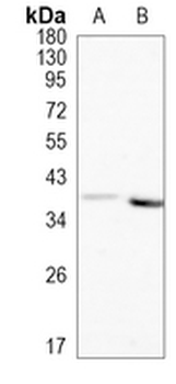 AKR1C1/2 Rabbit Monoclonal Antibody