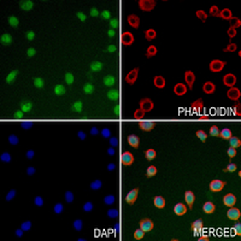 MCM7 Rabbit Monoclonal Antibody