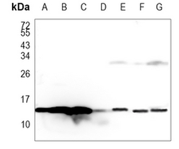 Histone H2B (Formyl-K108) Rabbit Monoclonal Antibody