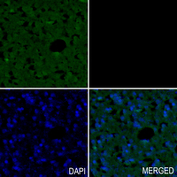 Histone H2B (Formyl-K108) Rabbit Monoclonal Antibody