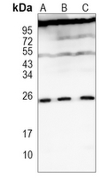 TLF Rabbit Monoclonal Antibody