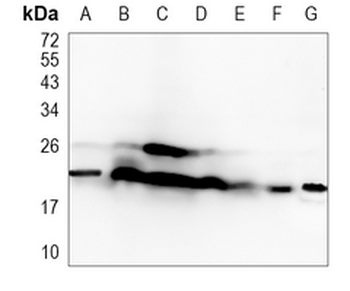 PSMB9 Rabbit Monoclonal Antibody