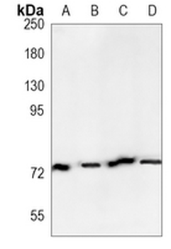 GlyRS Rabbit Monoclonal Antibody