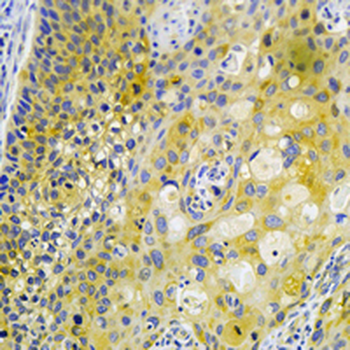 GlyRS Rabbit Monoclonal Antibody