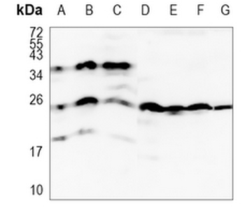 MAD2L2 Rabbit Monoclonal Antibody
