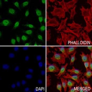 MAD2L2 Rabbit Monoclonal Antibody