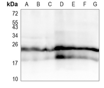 RISP Rabbit Monoclonal Antibody