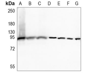 STAT5B Rabbit Monoclonal Antibody