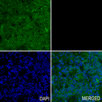 STAT5B Rabbit Monoclonal Antibody